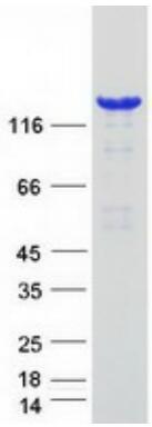 Coomassie blue staining of purified PLCB1 protein.